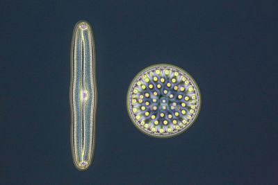 Diatoms, centric and pennate forms