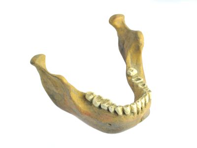 Homo heidelbergensis (Mandibel)